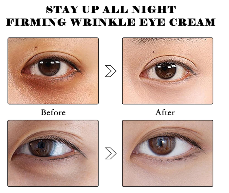 Instant Eye Tightener, Eye Bag Cream Instant Eye Tightener for Tightens and Smoothes for Dark Circles Fine Lines Puffiness